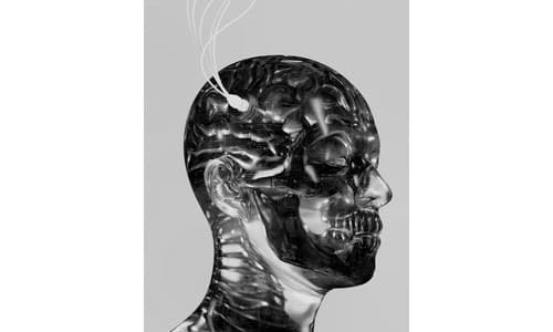 Stimulation cerebrale profonde